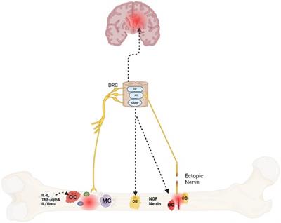 Frontiers | A bone to pick-cellular and molecular mechanisms of 